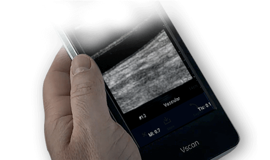 Wireless Ultrasound Probe Increases Imaging Accessibility - Ultrasound -  mobile.