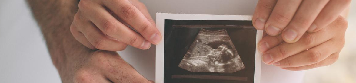 Fetal Ultrasound Image